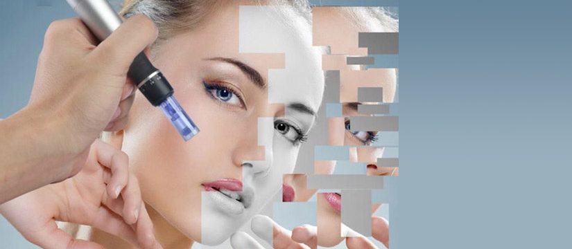 Microneedeling Face and skin rejuvenation treatments Exeter