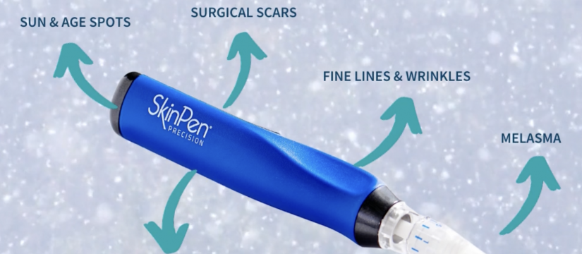 SkinPen - collagen induction therapy